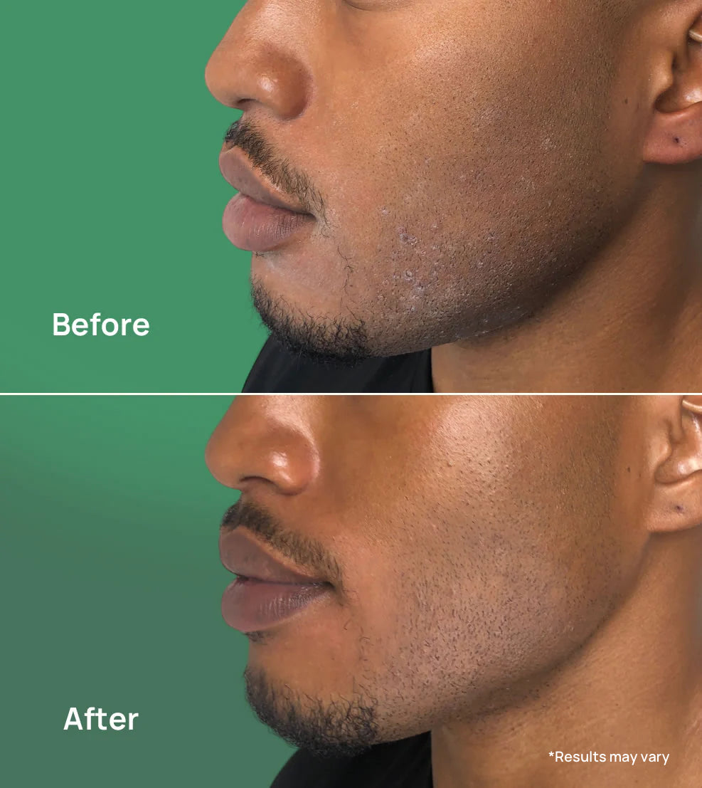 Playboy X Krete Hydrating Facial Serum